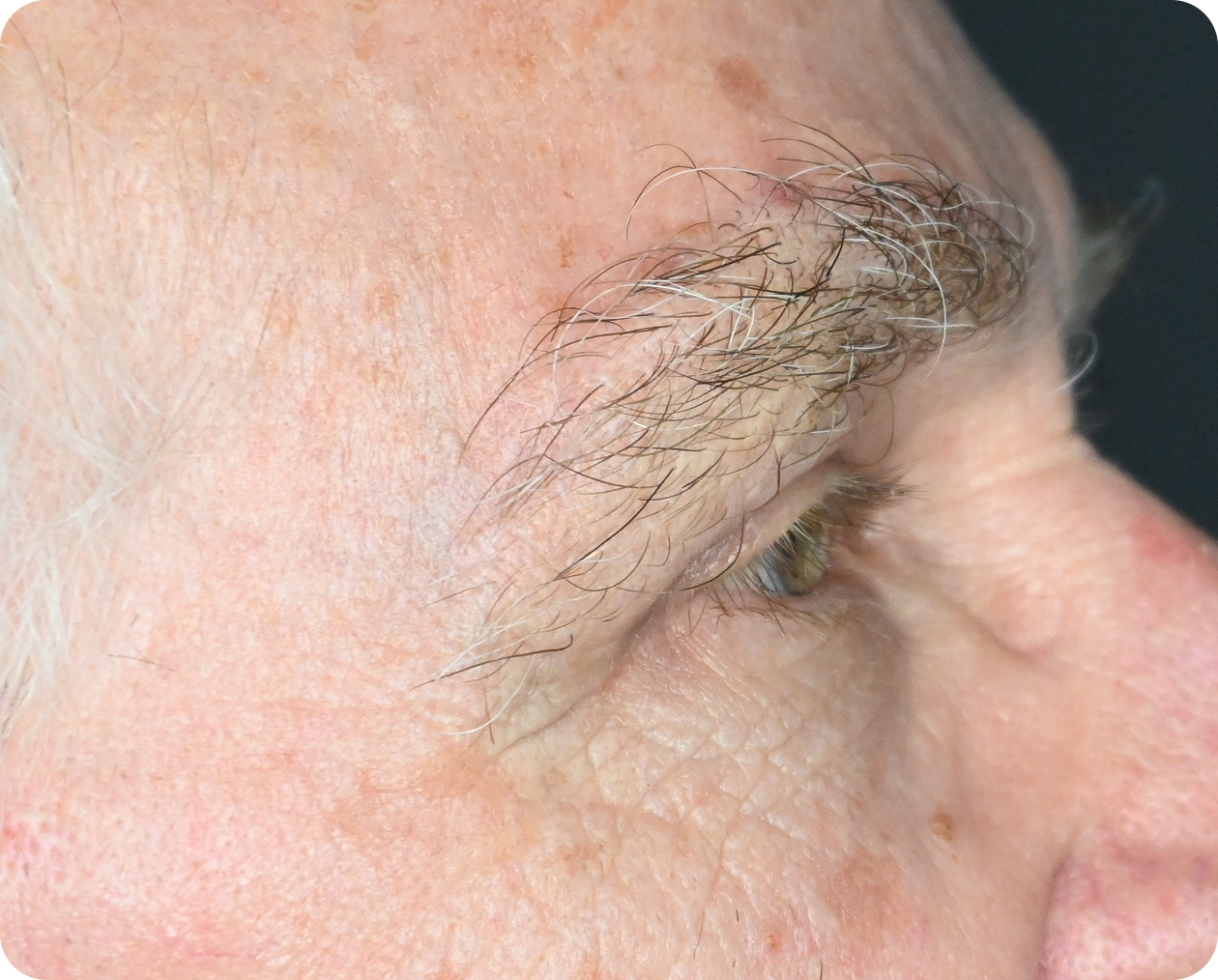 Nahaufnahme des Gesichts einer älteren Person, die das rechte Auge, die Augenbraue und die faltige, sommersprossige Haut mit sichtbaren feinen Linien und Altersflecken zeigt.