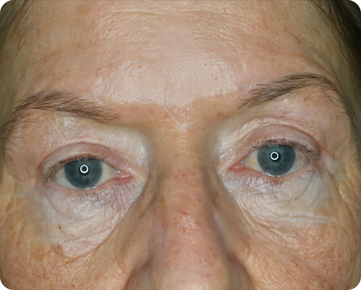 Nahaufnahme des Gesichts eines älteren Erwachsenen mit blauen Augen, hellen Augenbrauen und sichtbaren Falten um die Augen und auf der Stirn.