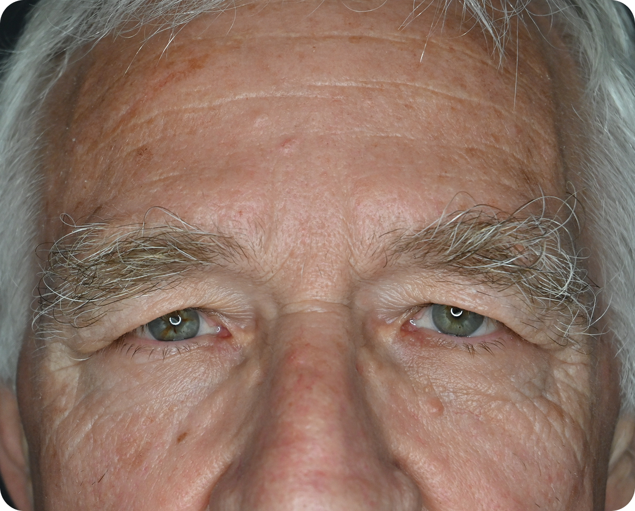 Nahaufnahme des Gesichts eines älteren Mannes mit Stirn, Augen, Augenbrauen und Hautstruktur mit sichtbaren Falten und weißem Haar.