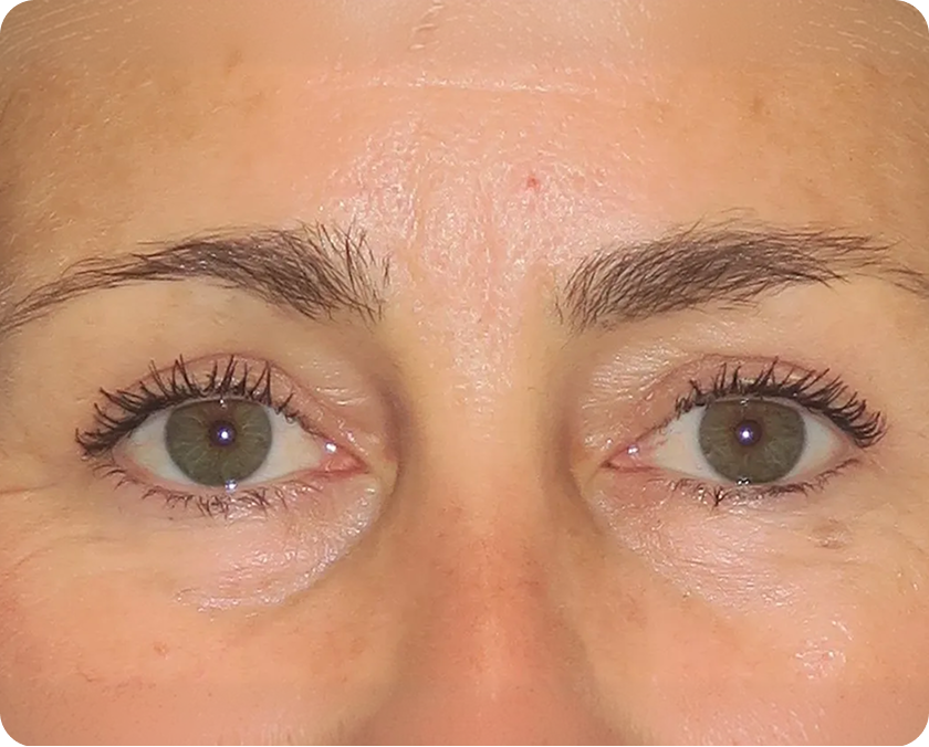 Nahaufnahme des Gesichts einer Person mit Augen und Augenbrauen mit sichtbarer Hautstruktur und einigen feinen Linien.