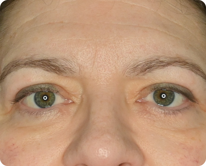 Nahaufnahme des Gesichts einer erwachsenen Person mit Schwerpunkt auf den grünen Augen und den Augenbrauen, mit sichtbarer Hauttextur und natürlicher Beleuchtung.