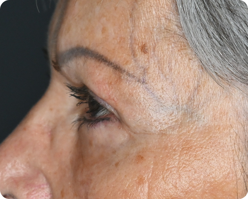 Seitliche Nahaufnahme des Gesichts einer älteren Frau mit Falten, Altersflecken, grauen Haaren und einer ausgeprägten Augenbraue vor einem dunklen Hintergrund.