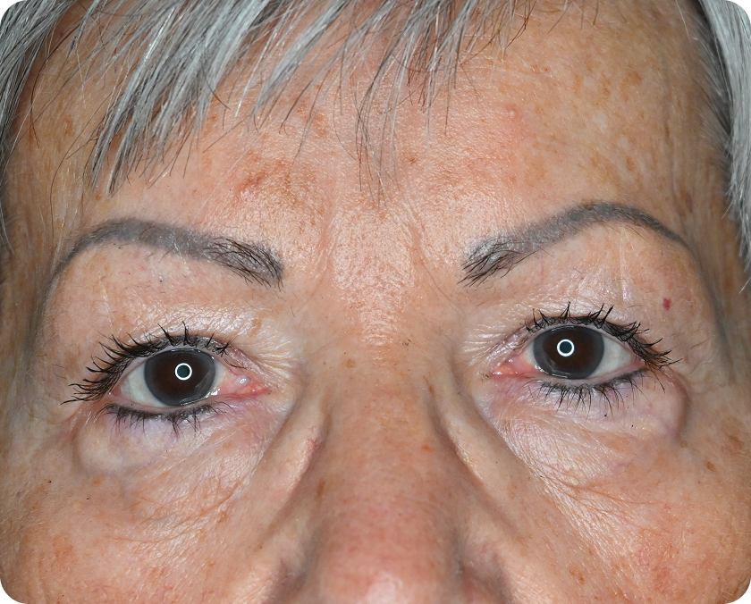 Nahaufnahme des Gesichts einer älteren Person, die beide Augen zeigt, mit sichtbaren Falten, leichtem Make-up und grauem Haar im oberen Teil des Bildes.