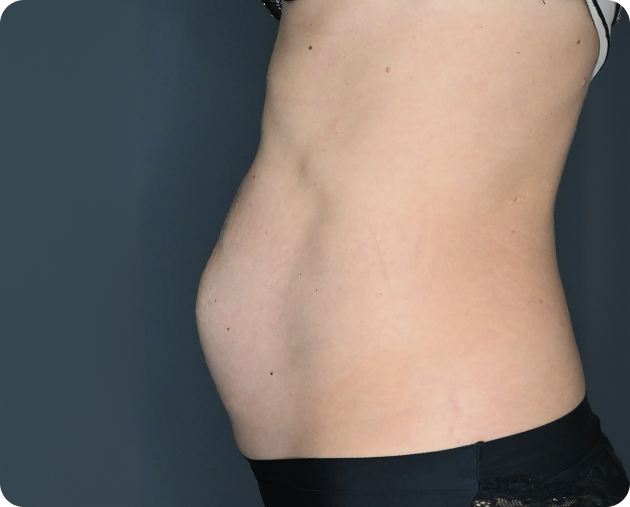 Seitenansicht des nackten Bauches und der Taille einer Person, die leichte Blähungen oder einen leicht hervortretenden Bauch zeigt, wobei die Person schwarze Unterwäsche vor einem einfarbigen Hintergrund trägt.