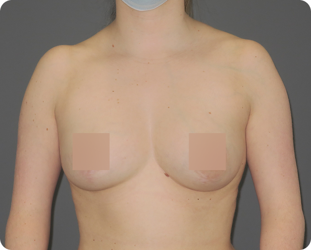 Eine Person mit nacktem Oberkörper und quadratischen Kästchen, die die Brustwarzen verdecken, steht vor einem schlichten grauen Hintergrund. Der Kopf ist teilweise sichtbar, und die Person trägt eine Maske.