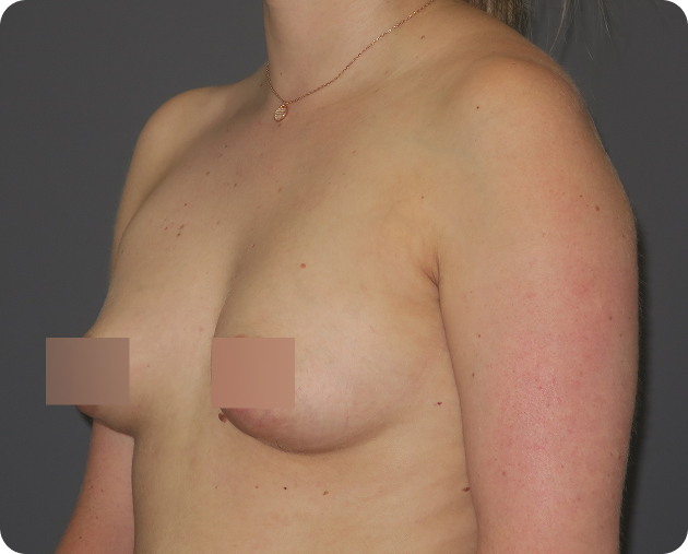 Eine Frau, die von den Schultern bis zur Taille in einem Dreiviertelwinkel gezeigt wird, mit teilweise zensierten Brüsten, vor einem schlichten dunklen Hintergrund.