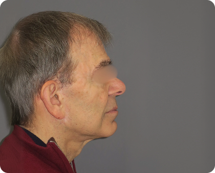 Profilansicht eines älteren Mannes mit grauen Haaren, der eine kastanienbraune Jacke trägt, vor einem schlichten grauen Hintergrund. Die Augen sind zum Schutz der Privatsphäre unscharf.