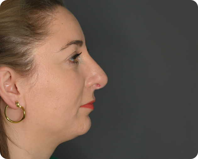 Eine Frau mit heller Haut und braunem Haar in einem Pferdeschwanz, die einen goldenen Ohrring trägt, ist im Profil vor einem dunklen Hintergrund dargestellt.