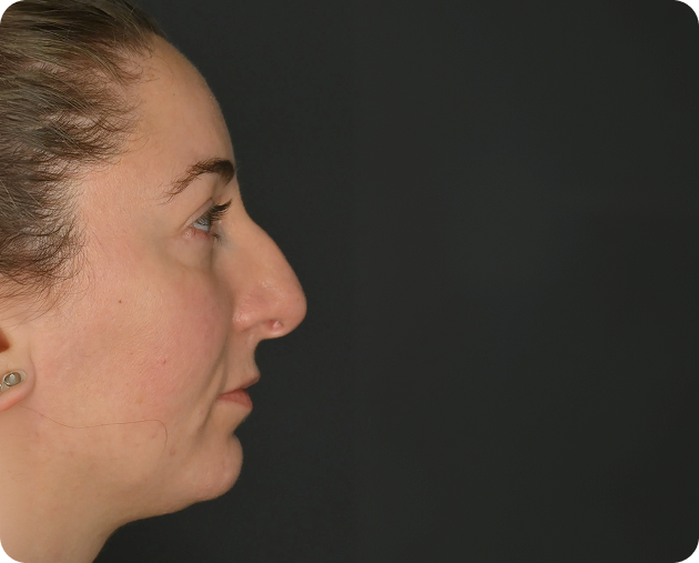 Profilansicht einer Person mit heller Haut und braunem Haar vor einem schlichten dunklen Hintergrund.