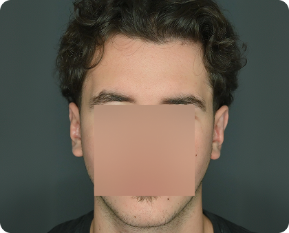 Eine Person mit kurzen, lockigen braunen Haaren blickt in die Kamera; ihre Nase und ihr Mund sind aus Gründen der Privatsphäre unscharf.