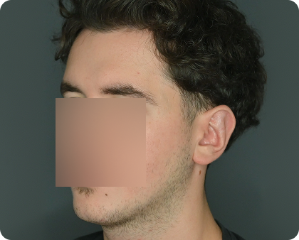 Eine Person mit kurzem, dunklem, gewelltem Haar ist im Seitenprofil vor einem dunklen Hintergrund abgebildet; ihr Gesicht ist durch ein unscharfes Quadrat verdeckt.