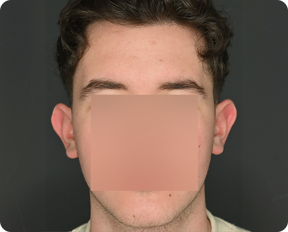 Ein junger Mann mit kurzen, dunklen Haaren blickt vor einem dunklen Hintergrund in die Kamera; seine Gesichtszüge sind durch eine große Unschärfe verdeckt.