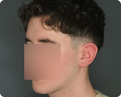 Seitenprofil einer Person mit kurzem, lockigem, dunklem Haar und verblasstem Haarschnitt; das Gesicht ist durch ein unscharfes Rechteck verdeckt.